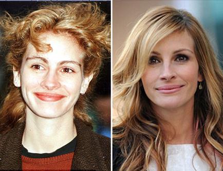 14 Celebrities τώρα και τότε