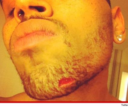 O τραυματισμός του Chris Brown