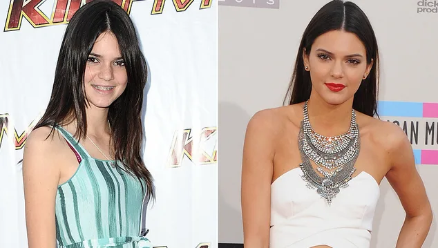 Κολάζ με δύο φωτογραφίες της Kendall Jenner από διαφορετικές ηλικίες.