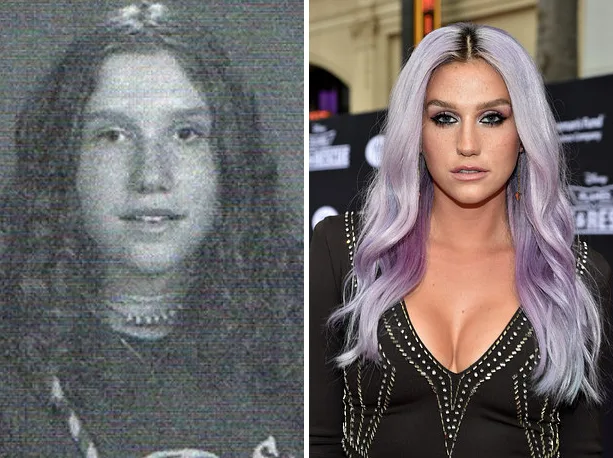 kesha