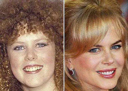 nicole-kidman_0