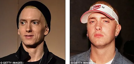 Ο Eminem «έλιωσε» από τα ναρκωτικά Πώς ήταν και πώς έγινε το πρόσωπο του διάσημου ράπερ εικόνες iefimerida.gr