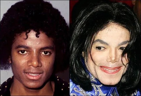 Ο Michael Jackson παρουσιάζεται σε δύο διαφορετικές περιόδους της ζωής του, δείχνοντας τις αλλαγές που υπέστη.