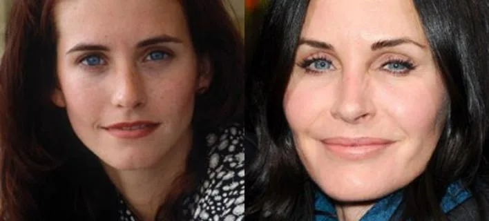 Κολάζ με την Courteney Cox πριν και μετά τις αισθητικές επεμβάσεις.