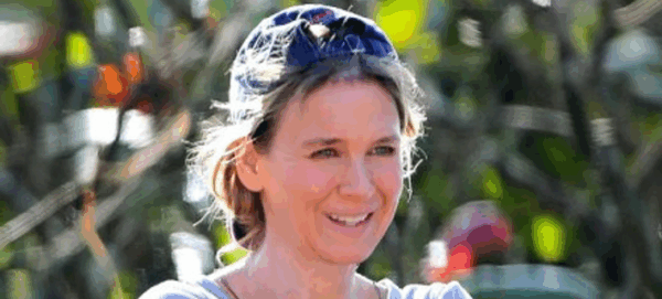 Η Renee Zellweger δεν μπορεί πια ούτε να γελάσει