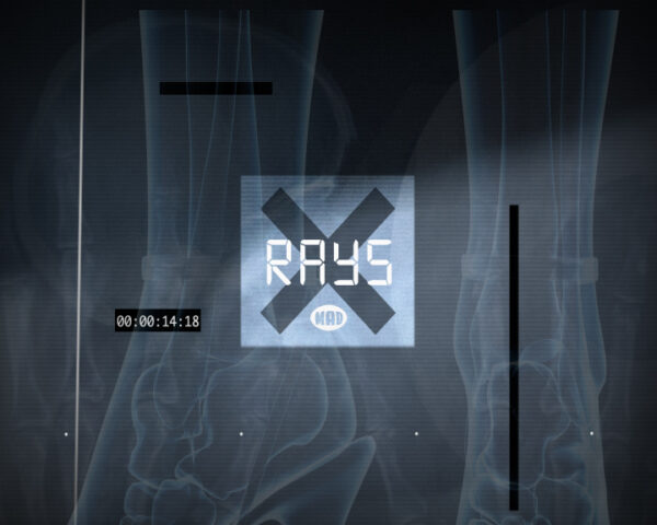 Απόψε στις 18.00 στα Μad X-Rays: We Love Surf!