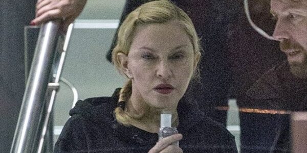 Τι συμβαίνει με την Madonna; Δείτε την τεράστια αλλαγή στο πρόσωπό της