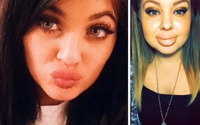 Η Kylie Jenner δίπλα σε μια κοπέλα με πρησμένα χείλη.