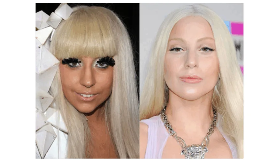 Η Lady Gaga σε δύο διαφορετικές χρονικές περιόδους, πριν και μετά από αισθητικές επεμβάσεις.