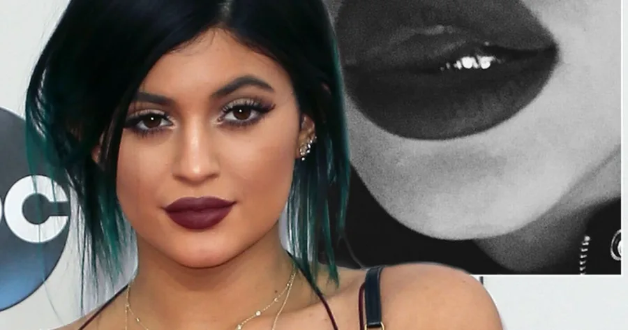 Η Kylie Jenner σε εκδήλωση με σκούρο κραγιόν και δίπλα μια ασπρόμαυρη κοντινή φωτογραφία των χειλιών της.
