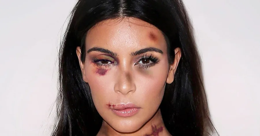 Η Kim Kardashian με μακιγιάζ που προσομοιώνει μώλωπες και τραύματα στο πρόσωπο.