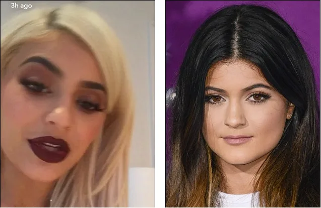kylie-after-before