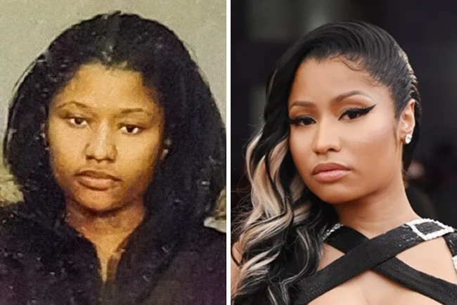 Κολάζ με δύο φωτογραφίες της Nicki Minaj, μία από το παρελθόν και μία πρόσφατη.