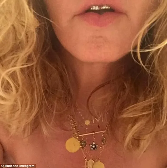 Κοντινό πλάνο της Madonna με χρυσά κοσμήματα και grillz στα δόντια.