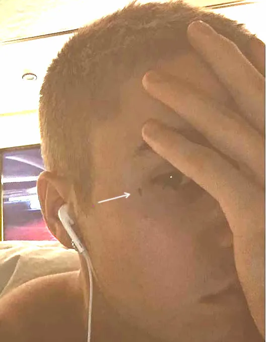 Ο Justin Bieber δείχνει ένα μικρό τατουάζ δίπλα στο μάτι του.