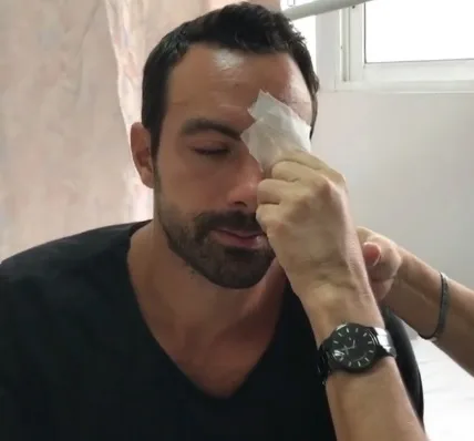 Ο Σάκης Τανιμανίδης με γάζα στο μέτωπο.
