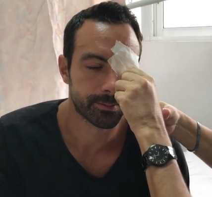 Τραυματίστηκε ο Σάκης Τανιμανίδης!