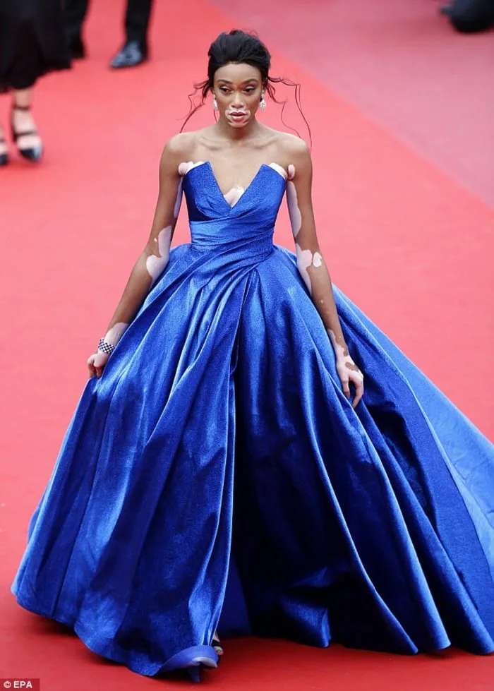 Η Winnie Harlow με μπλε τουαλέτα στο κόκκινο χαλί των Καννών.