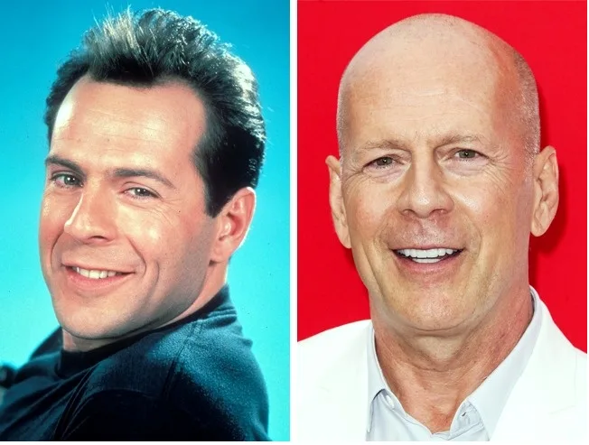 Ο Bruce Willis σε νεαρή ηλικία με μαλλιά και σήμερα, ως ένας από τους καραφλούς του Hollywood.
