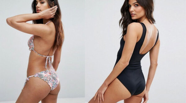 Η Asos σταμάτησε να κάνει Photoshop στα μοντέλα και αφήνει πλέον αρετουσάριστες τις ραγάδες τους