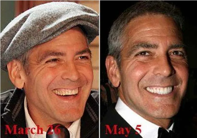 Κοντινά πλάνα του George Clooney σε δύο διαφορετικές ημερομηνίες.
