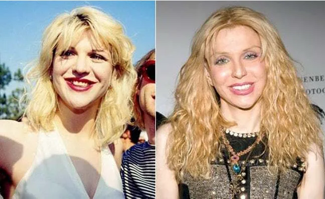 Κολάζ με δύο φωτογραφίες της Courtney Love από διαφορετικές περιόδους.