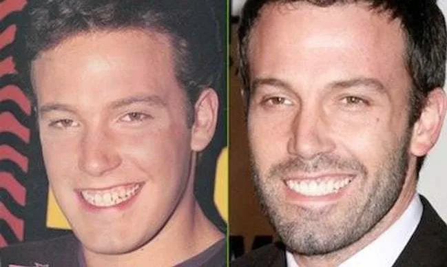 Κολάζ με δύο φωτογραφίες του Ben Affleck σε νεαρή και ωριμότερη ηλικία.