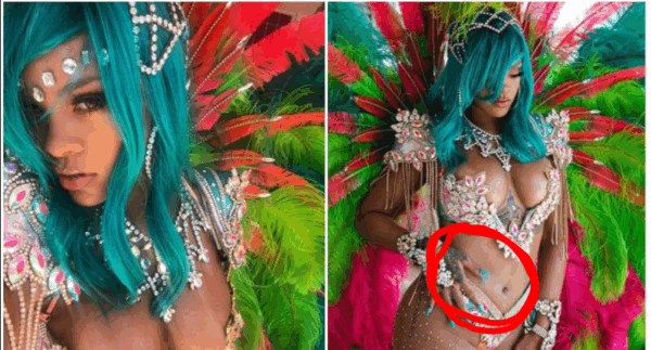 H Rihanna κατηγορείται ότι έκανε (αποτυχημένο) Photoshop σε φωτογραφία της