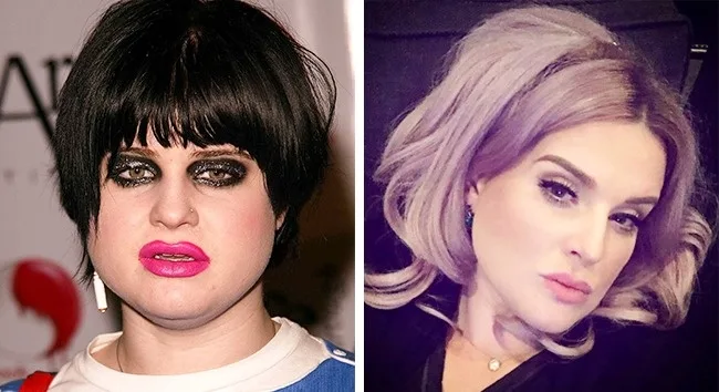 Κολάζ με δύο φωτογραφίες της Kelly Osbourne που δείχνουν την αλλαγή στην εμφάνισή της.