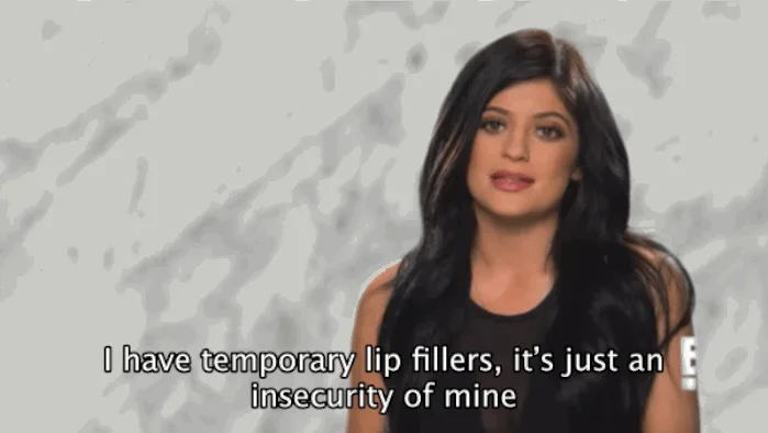kylie jenner έφτιαξε τα χείλια της