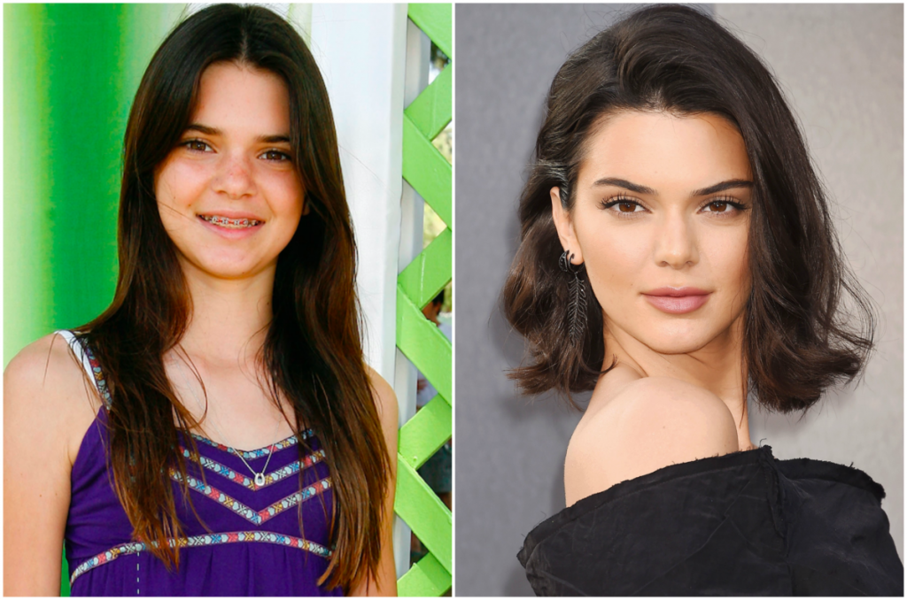 πόσο έχουν αλλάξει οι Kardashians