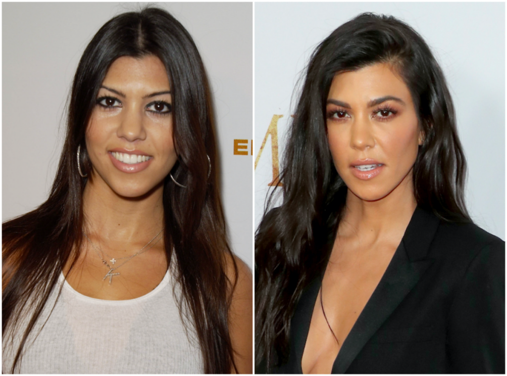 πόσο έχουν αλλάξει οι Kardashians