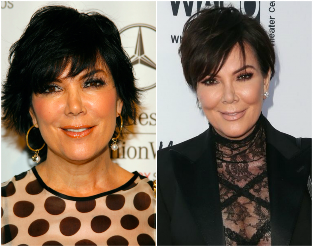 πόσο έχουν αλλάξει οι Kardashians