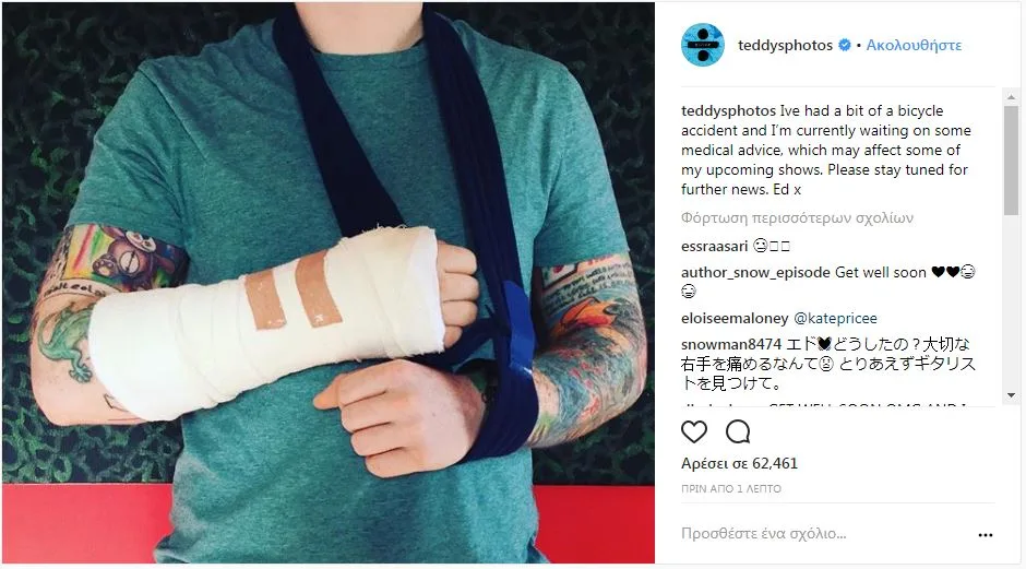 Ο Ed Sheeran με το δεξί του χέρι σε γύψο και ανάρτηση μετά από ατύχημα με ποδήλατο.