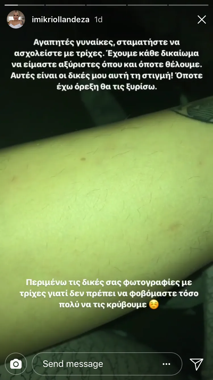 Κοντινό πλάνο σε πόδι με τρίχες από Instagram story της Μικρής Ολλανδέζας.