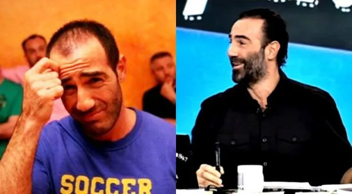 Κολάζ με δύο φωτογραφίες του Αντώνη Κανάκη που δείχνουν την αλλαγή στα μαλλιά του.