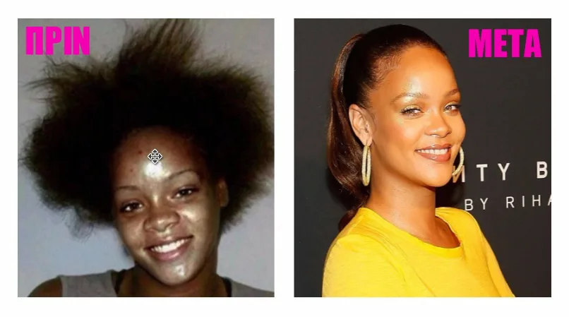 Κολάζ με τη Rihanna πριν και μετά την καταξίωσή της.