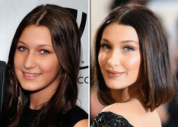 Bella Hadid πριν και μετά