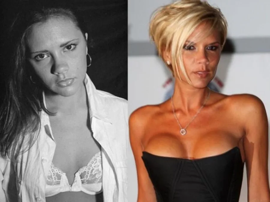 Κολάζ με δύο φωτογραφίες της Victoria Beckham, μία παλαιότερη ασπρόμαυρη και μία μεταγενέστερη έγχρωμη.