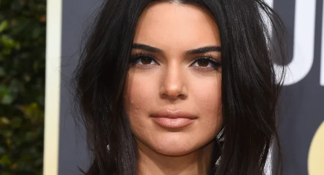 Δεν είναι η πρώτη φορά πάντως που η ακμή της Kendall Jenner γίνεται θέμα και ίδια μιλάει για αυτή. «Είχα πολύ μεγάλο πρόβλημα με την ακμή όταν ήμουν μικρή.