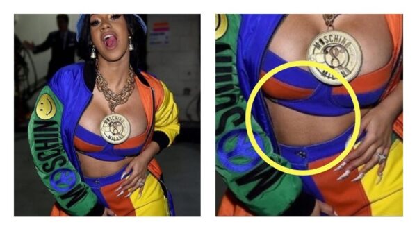 Haters άσκησαν κριτική στην Cardi B για τις τρίχες στην κοιλιά της και οι φαν της είχαν την καλύτερη απάντηση!