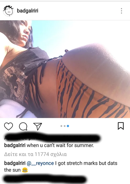 Rihanna παραδέχτηκε πως έχει ραγάδες