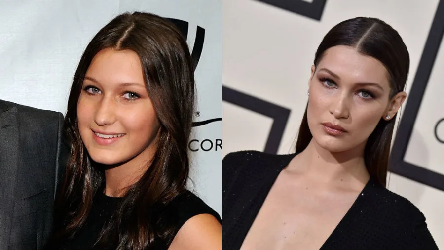Bella Hadid μίλησε για το αν έχει βάλει χείλια