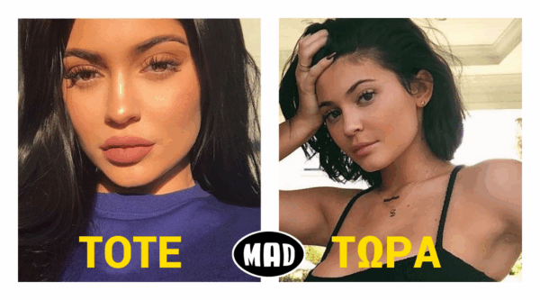 Η Kylie Jenner μας δείχνει τα μικρότερα χείλια της πριν τα κάνει πιο μεγάλα… με μακιγιάζ!
