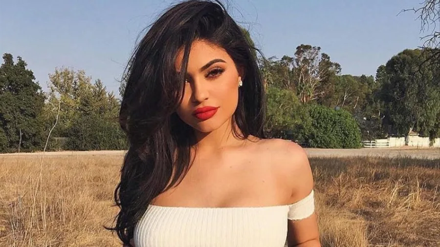 Kylie Jenner έβγαλε τα lip fillers