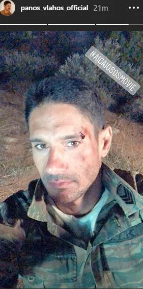 Ο Πάνος Βλάχος με στρατιωτική στολή και μακιγιάζ τραυματισμού στο πρόσωπο.