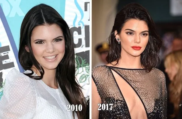 Η Kendall Jenner σε σύγκριση φωτογραφιών από το 2010 και το 2017.