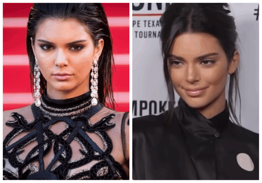 τι άλλαξε στο πρόσωπο της η Kendall