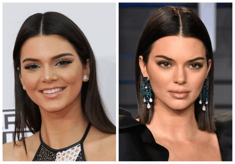 τι άλλαξε στο πρόσωπο της η Kendall