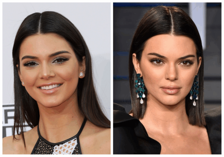 τι άλλαξε στο πρόσωπο της η Kendall